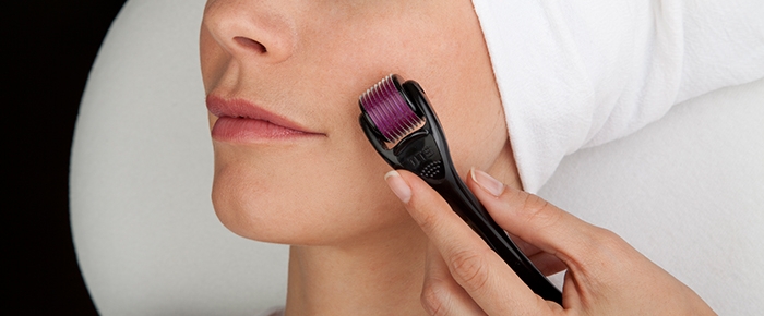 Derma roller scar treatment