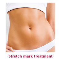 Stretch mark treatment